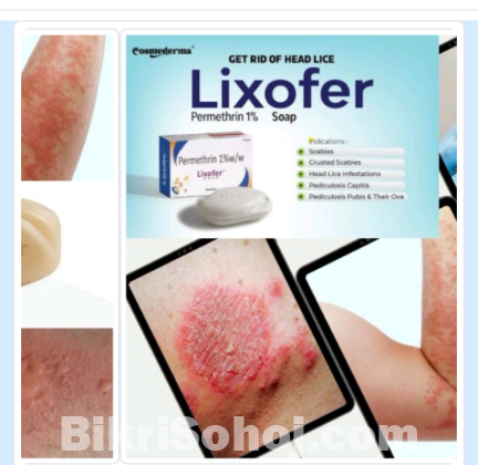 পারমেথিন ১% সাবান চুলকানি এলার্জিমার কাজ করে